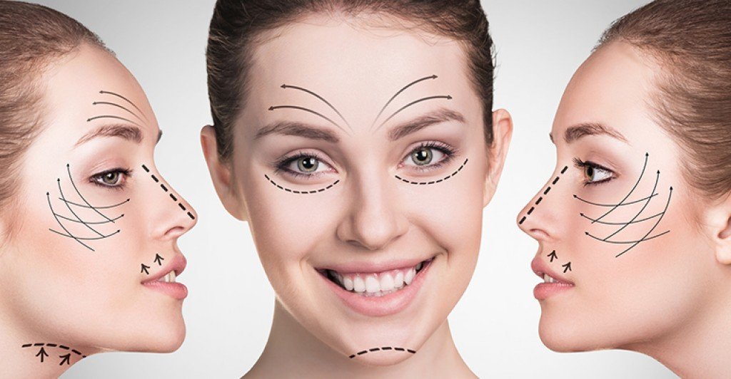 Ameliyatsız İple Yüz Gençleştirme